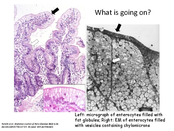 What is going on? Peretti et al. Orphanet Journal of Rare Diseases 2010 5: