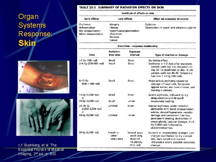 Organ Systems Response: Skin c. f. Bushberg, et al. The Essential Physics of Medical