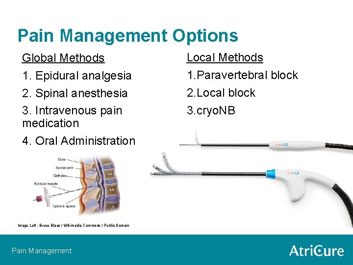 Pain Management Options Global Methods 1. Epidural analgesia 2. Spinal anesthesia 3. Intravenous pain