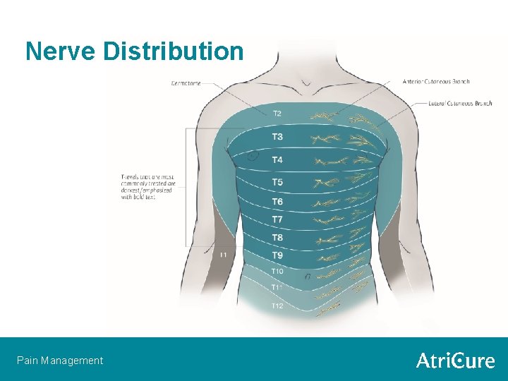 Nerve Distribution Pain Management 