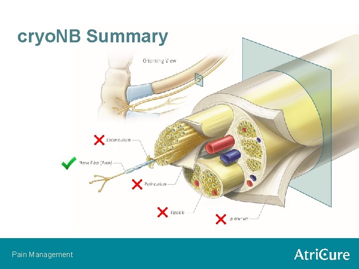 cryo. NB Summary Pain Management 