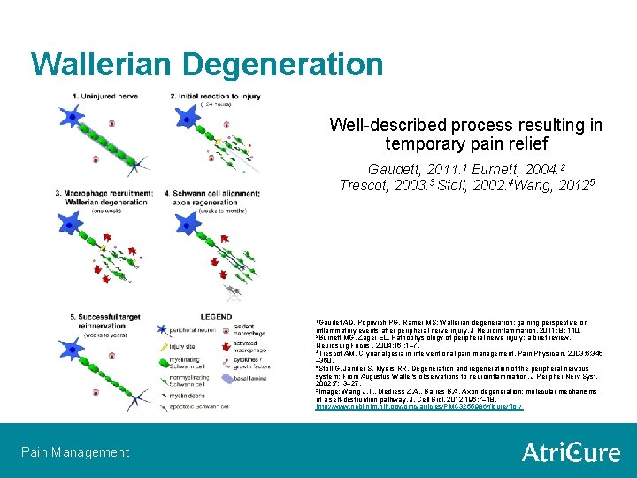 Wallerian Degeneration Well-described process resulting in temporary pain relief Gaudett, 2011. 1 Burnett, 2004.