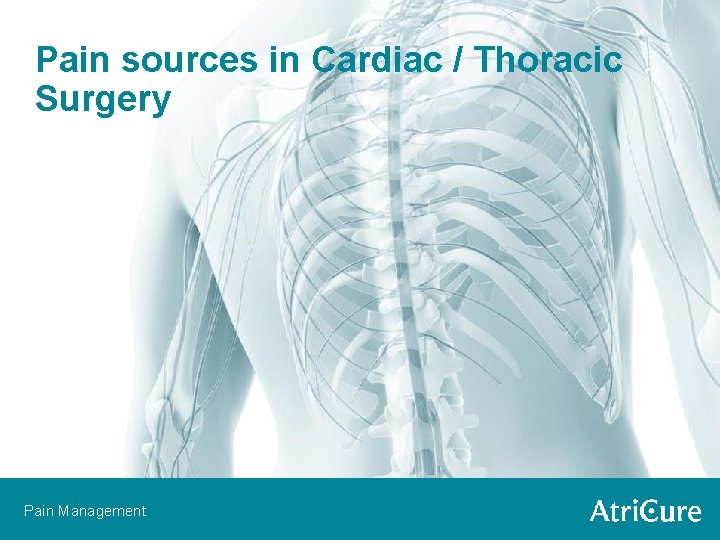 Pain sources in Cardiac / Thoracic Surgery Pain Management 