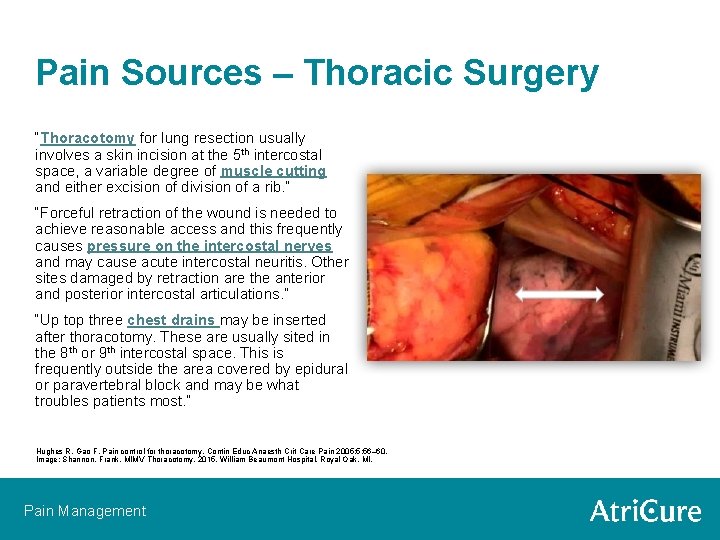 Pain Sources – Thoracic Surgery “Thoracotomy for lung resection usually involves a skin incision