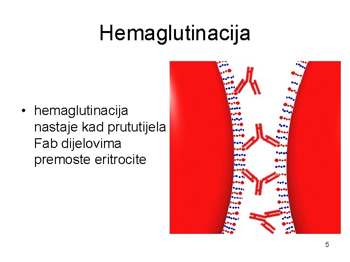 Hemaglutinacija • hemaglutinacija nastaje kad prututijela Fab dijelovima premoste eritrocite 5 