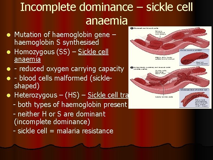 Incomplete dominance – sickle cell anaemia Mutation of haemoglobin gene – haemoglobin S synthesised