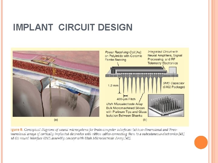IMPLANT CIRCUIT DESIGN 