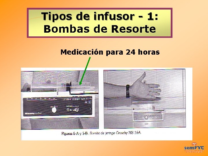 Tipos de infusor - 1: Tipos de infusor - 1 Bombas de Resorte Medicación