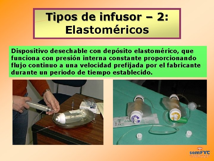 Tipos de infusor – 2: Tipos de infusor – 2 Elastoméricos Dispositivo desechable con