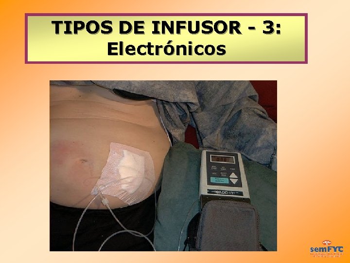 TIPOS DE INFUSOR - 3: Electrónicos 