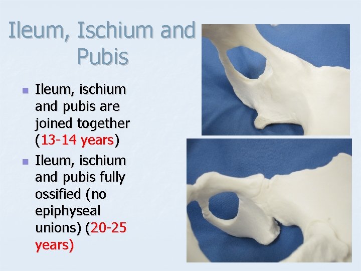 Ileum, Ischium and Pubis n n Ileum, ischium and pubis are joined together (13