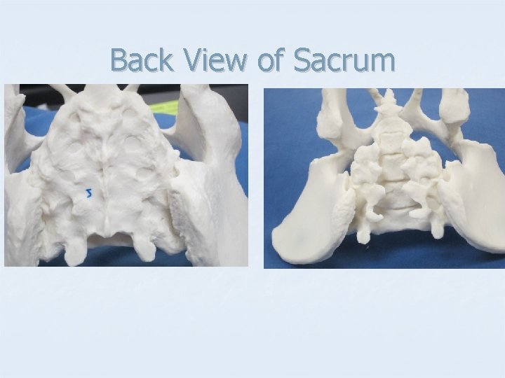 Back View of Sacrum 