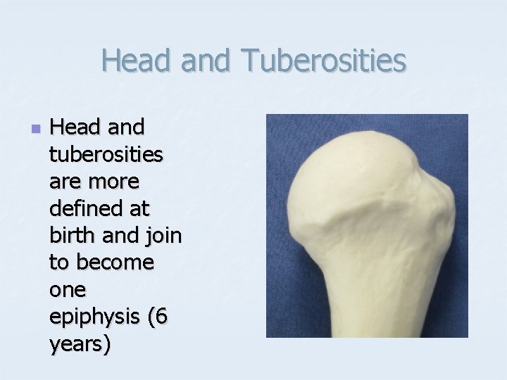 Head and Tuberosities n Head and tuberosities are more defined at birth and join