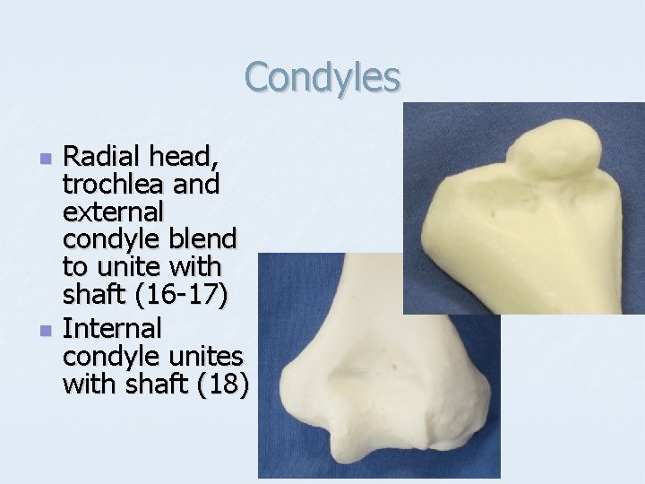 Condyles n n Radial head, trochlea and external condyle blend to unite with shaft