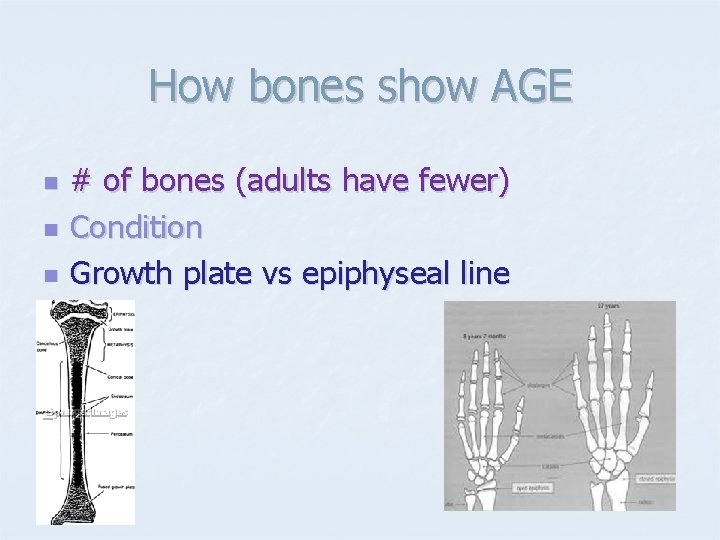 How bones show AGE n n n # of bones (adults have fewer) Condition