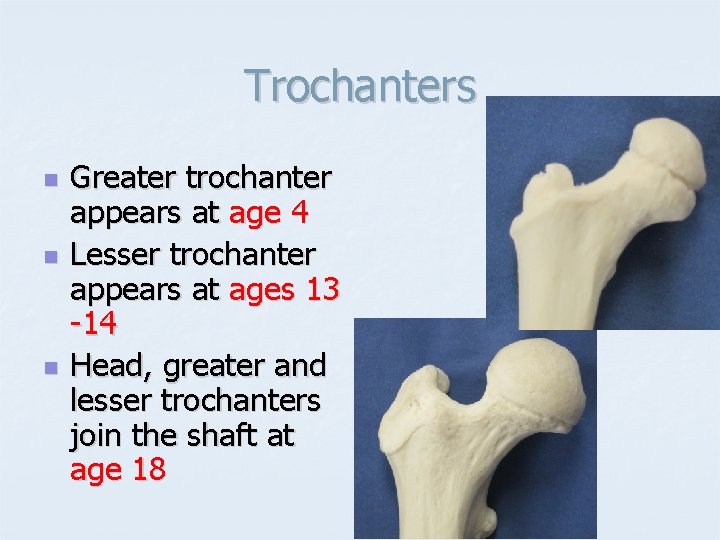 Trochanters n n n Greater trochanter appears at age 4 Lesser trochanter appears at