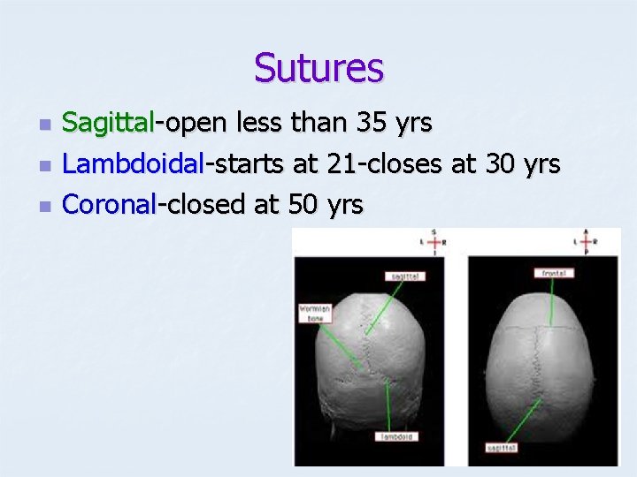 Sutures n n n Sagittal-open less than 35 yrs Lambdoidal-starts at 21 -closes at