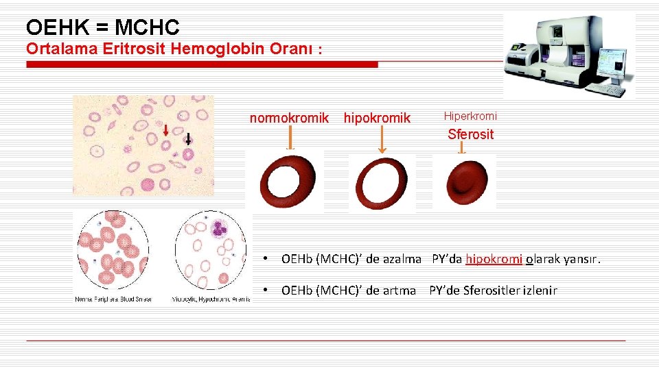 OEHK = MCHC Ortalama Eritrosit Hemoglobin Oranı : normokromik hipokromik Hiperkromi Sferosit • OEHb