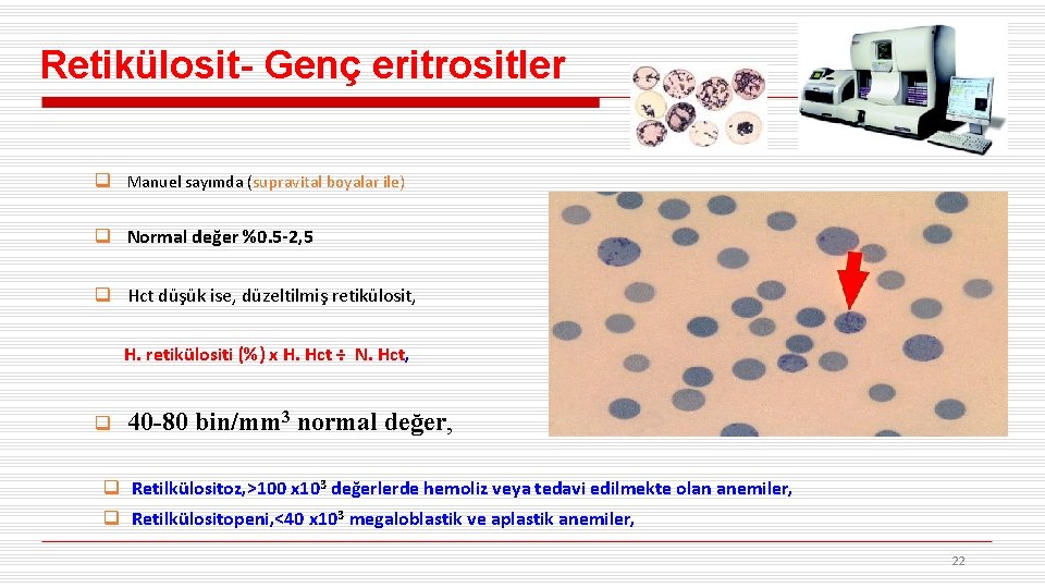 Retikülosit- Genç eritrositler q Manuel sayımda (supravital boyalar ile) q Normal değer %0. 5