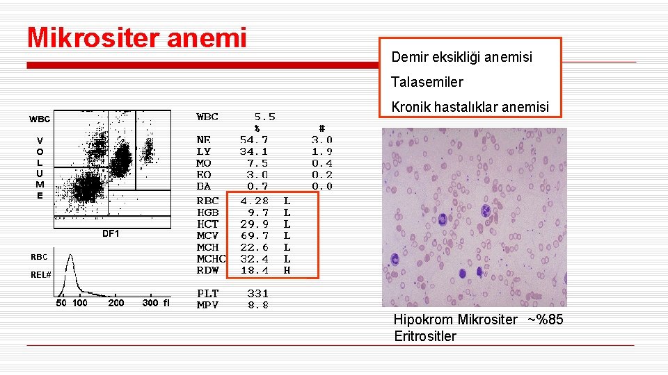 Mikrositer anemi Demir eksikliği anemisi Talasemiler Kronik hastalıklar anemisi Hipokrom Mikrositer ~%85 Eritrositler 
