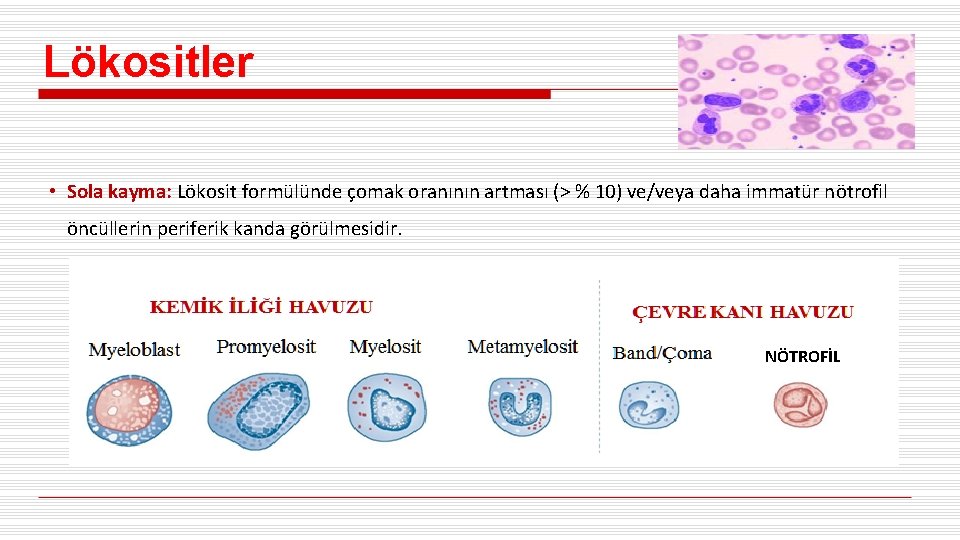 Lökositler • Sola kayma: Lökosit formülünde çomak oranının artması (> % 10) ve/veya daha