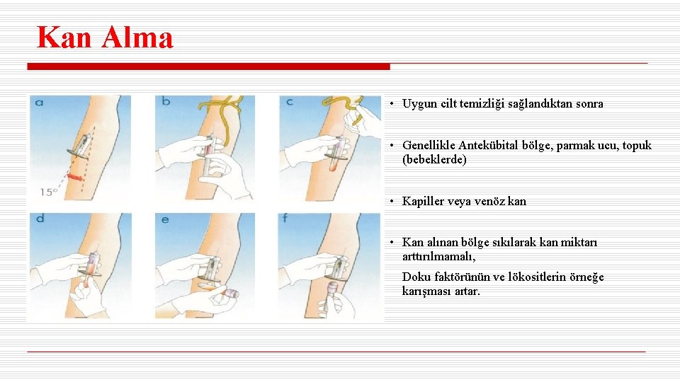 Kan Alma • Uygun cilt temizliği sağlandıktan sonra • Genellikle Antekübital bölge, parmak ucu,
