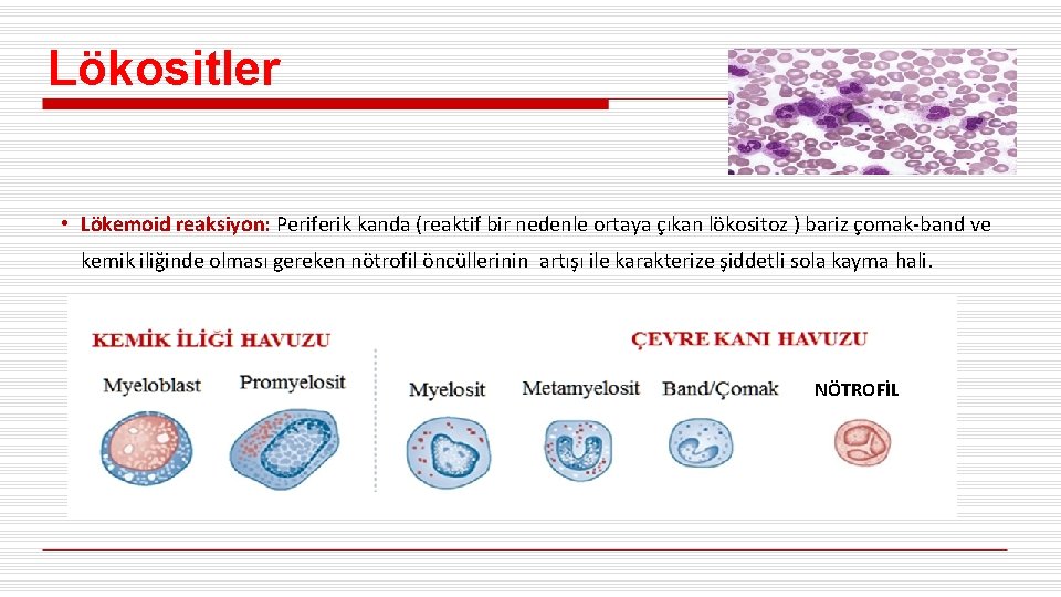 Lökositler • Lökemoid reaksiyon: Periferik kanda (reaktif bir nedenle ortaya çıkan lökositoz ) bariz
