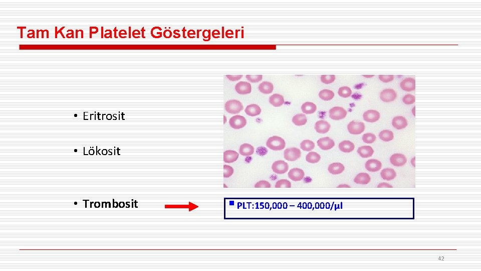Tam Kan Platelet Göstergeleri • Eritrosit • Lökosit • Trombosit § PLT: 150, 000