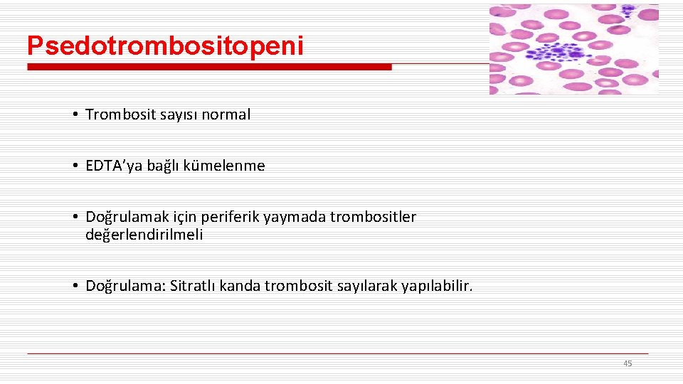 Psedotrombositopeni • Trombosit sayısı normal • EDTA’ya bağlı kümelenme • Doğrulamak için periferik yaymada