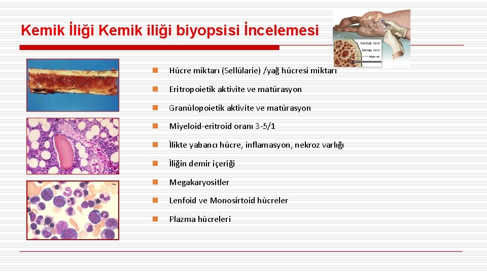 Kemik İliği Kemik iliği biyopsisi İncelemesi n Hücre miktarı (Sellülarie) /yağ hücresi miktarı n