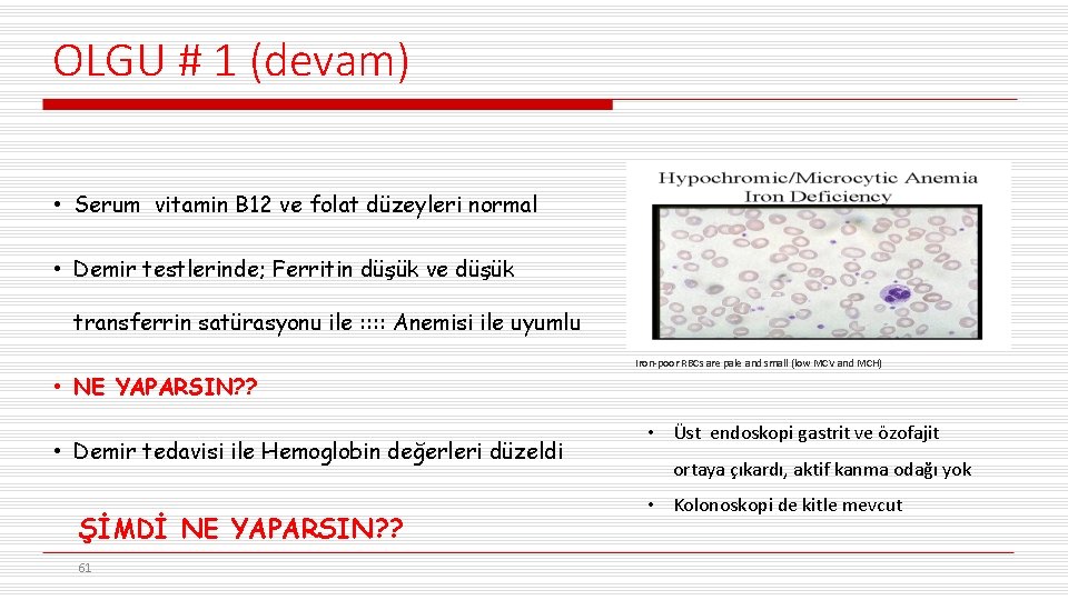OLGU # 1 (devam) • Serum vitamin B 12 ve folat düzeyleri normal •