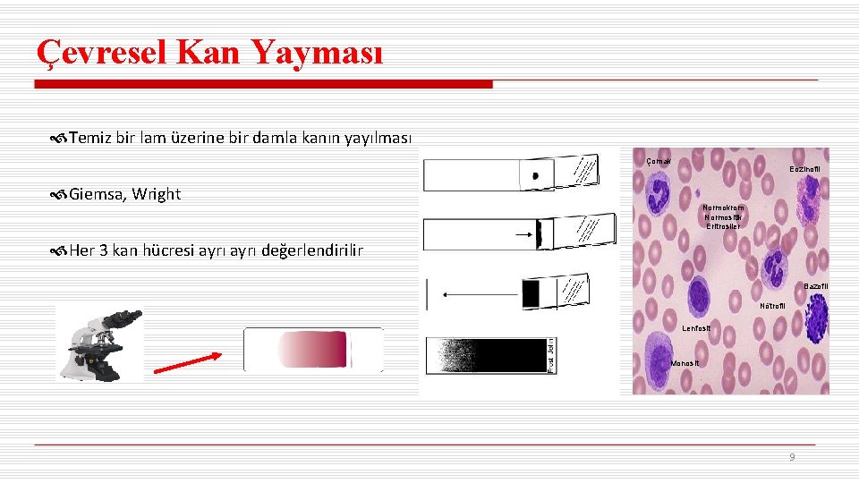 Çevresel Kan Yayması Temiz bir lam üzerine bir damla kanın yayılması Çomak Eozinofil Giemsa,