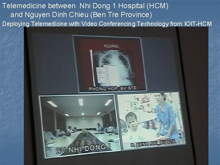 Telemedicine between Nhi Dong 1 Hospital (HCM) and Nguyen Dinh Chieu (Ben Tre Province)