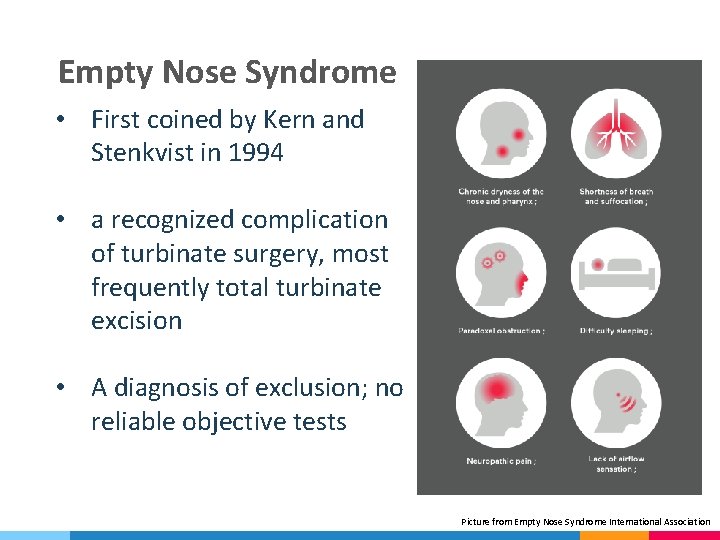 Empty Nose Syndrome • First coined by Kern and Stenkvist in 1994 • a