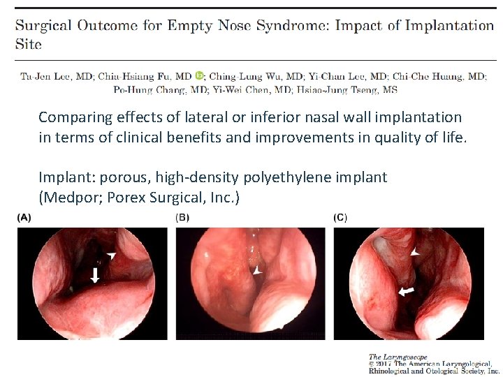 Comparing effects of lateral or inferior nasal wall implantation in terms of clinical benefits