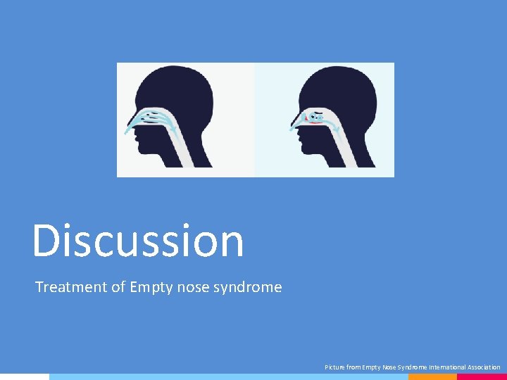 Discussion Treatment of Empty nose syndrome Picture from Empty Nose Syndrome International Association 