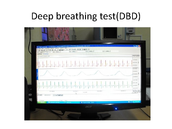 Deep breathing test(DBD) 