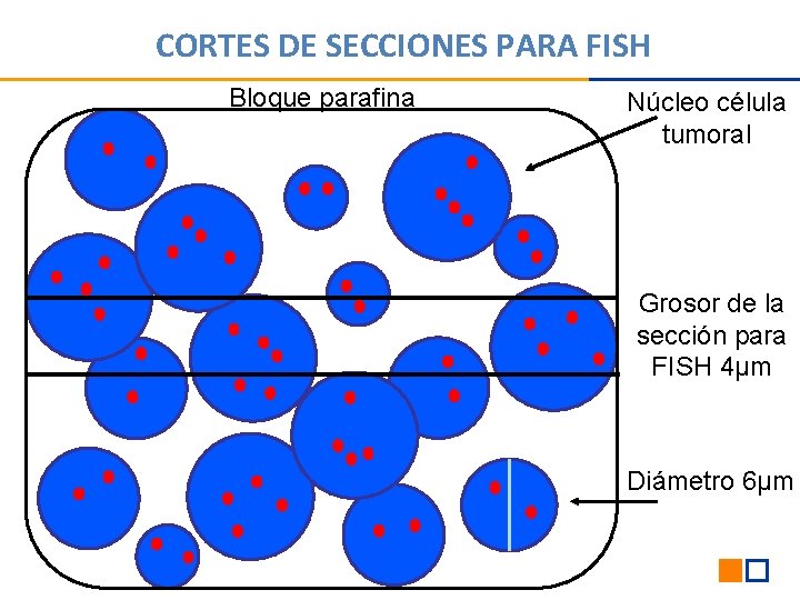 CORTES DE SECCIONES PARA FISH Bloque parafina Núcleo célula tumoral Grosor de la sección