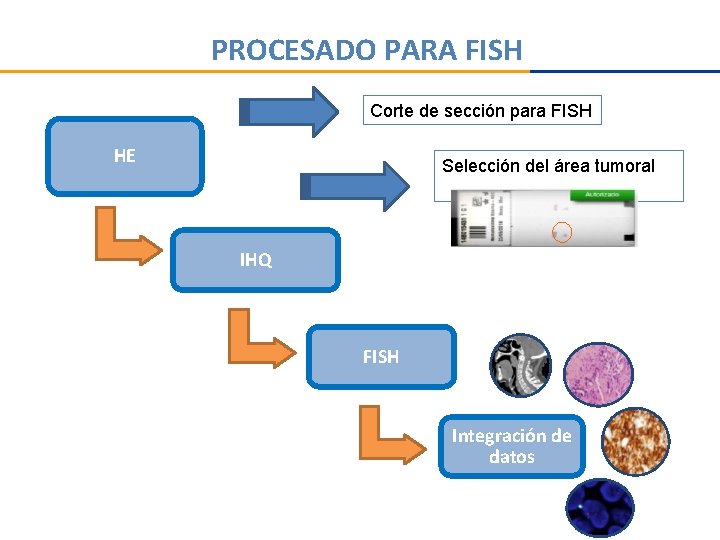 PROCESADO PARA FISH Corte de sección para FISH HE Selección del área tumoral IHQ