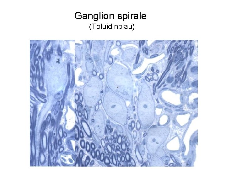 Ganglion spirale (Toluidinblau) N 