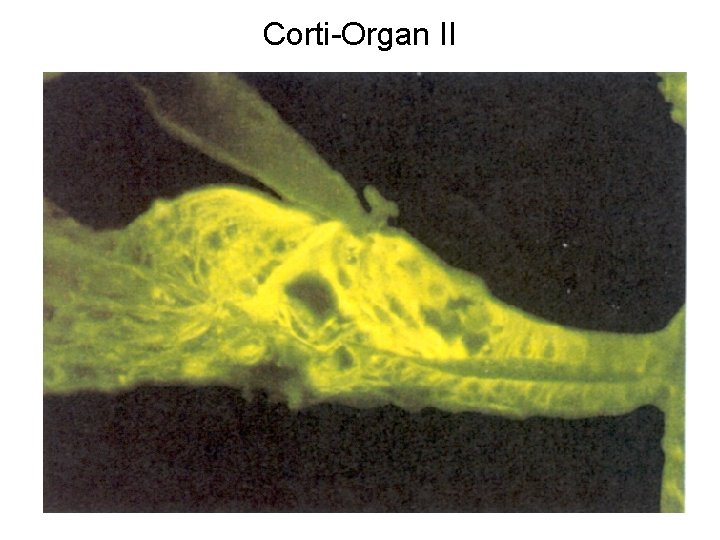 Corti-Organ II 