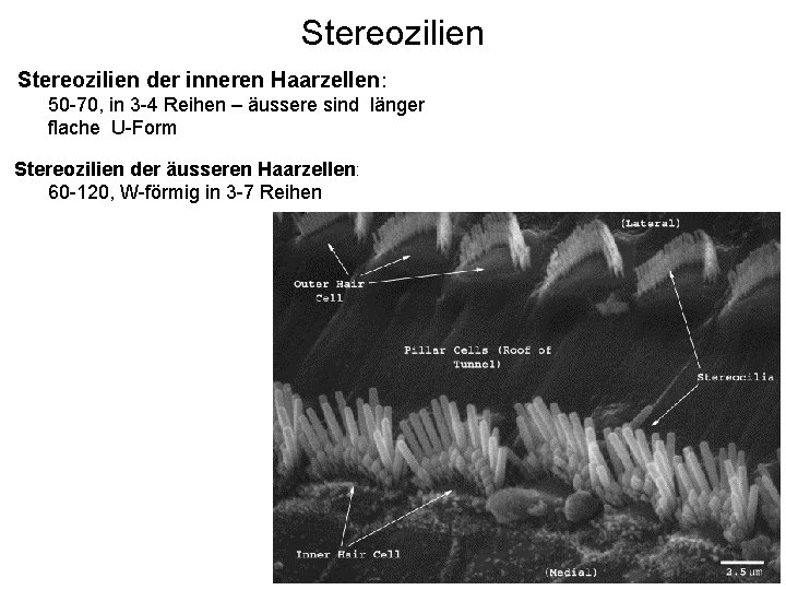 Stereozilien der inneren Haarzellen: 50 -70, in 3 -4 Reihen – äussere sind länger