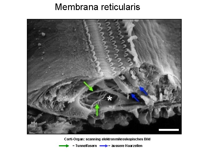 Membrana reticularis Corti-Organ: scanning elektronmikroskopisches Bild = Tunnelfasern = äussere Haarzellen 