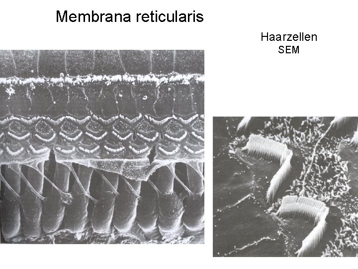 Membrana reticularis Haarzellen SEM 