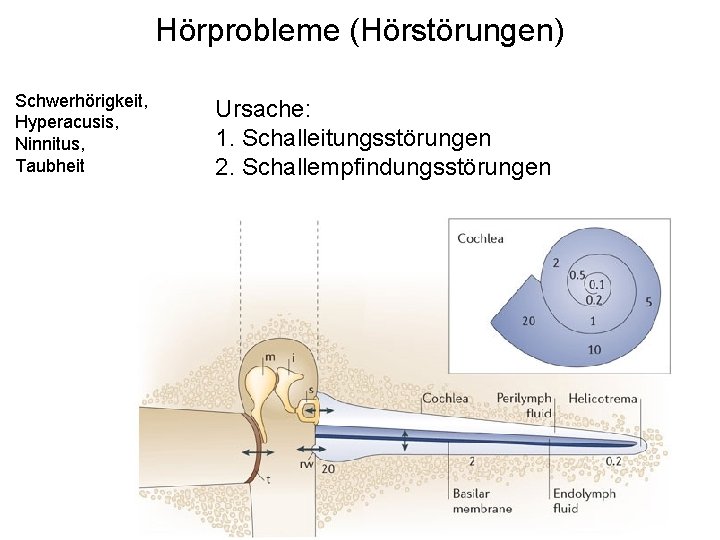 Hörprobleme (Hörstörungen) Schwerhörigkeit, Hyperacusis, Ninnitus, Taubheit Ursache: 1. Schalleitungsstörungen 2. Schallempfindungsstörungen 