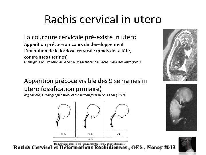 Rachis cervical in utero La courbure cervicale pré-existe in utero Apparition précoce au cours