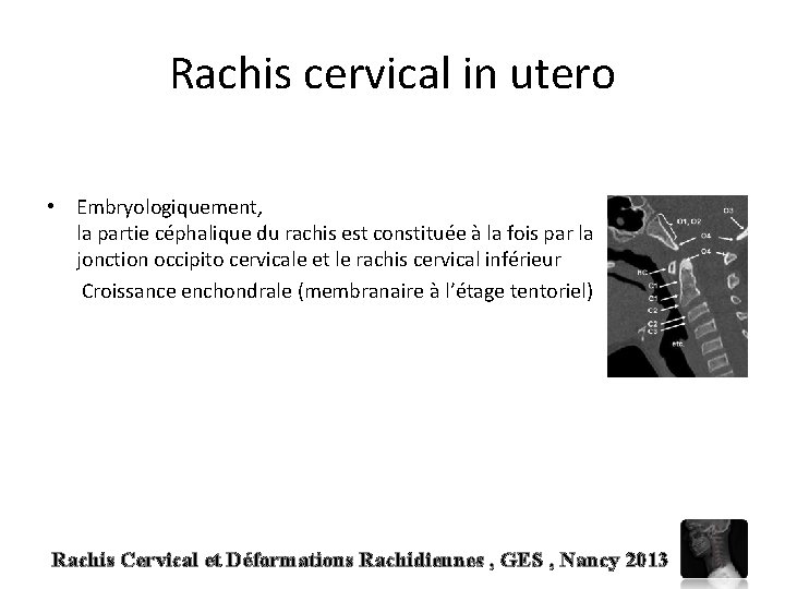 Rachis cervical in utero • Embryologiquement, la partie céphalique du rachis est constituée à