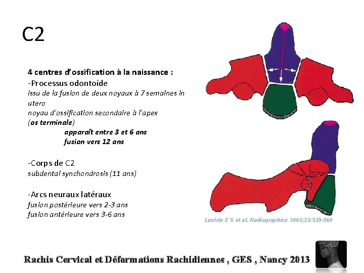 C 2 4 centres d’ossification à la naissance : -Processus odontoïde issu de la