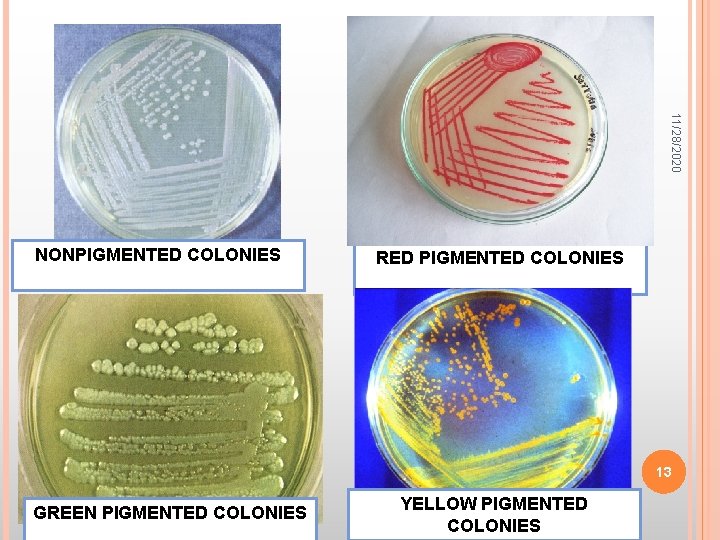 11/28/2020 NONPIGMENTED COLONIES RED PIGMENTED COLONIES 13 GREEN PIGMENTED COLONIES YELLOW PIGMENTED COLONIES 
