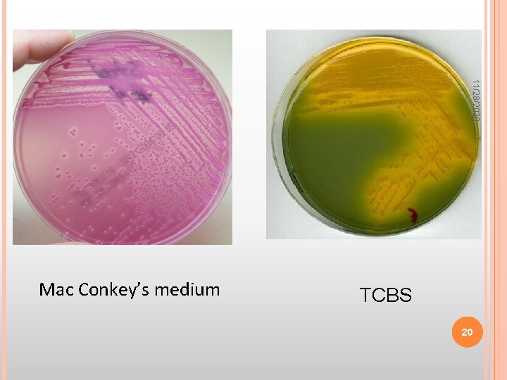 11/28/2020 Mac Conkey’s medium TCBS 20 